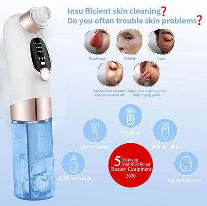 Blackhead Remover - Zero HUB